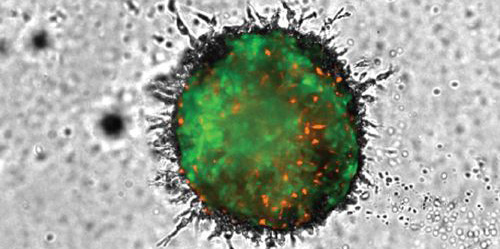 3D Spheroid-Based Tumor Invasion Assay<br>