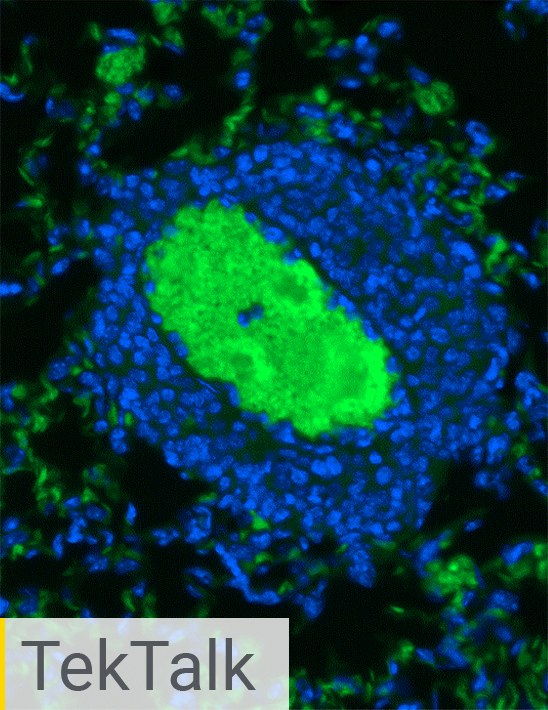 Advancing Cancer Cell Invasion and Metastasis Research with Powerful Cell Analysis Tools