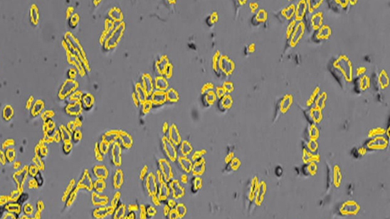 Gen5 Imaging Virtual Demo Video