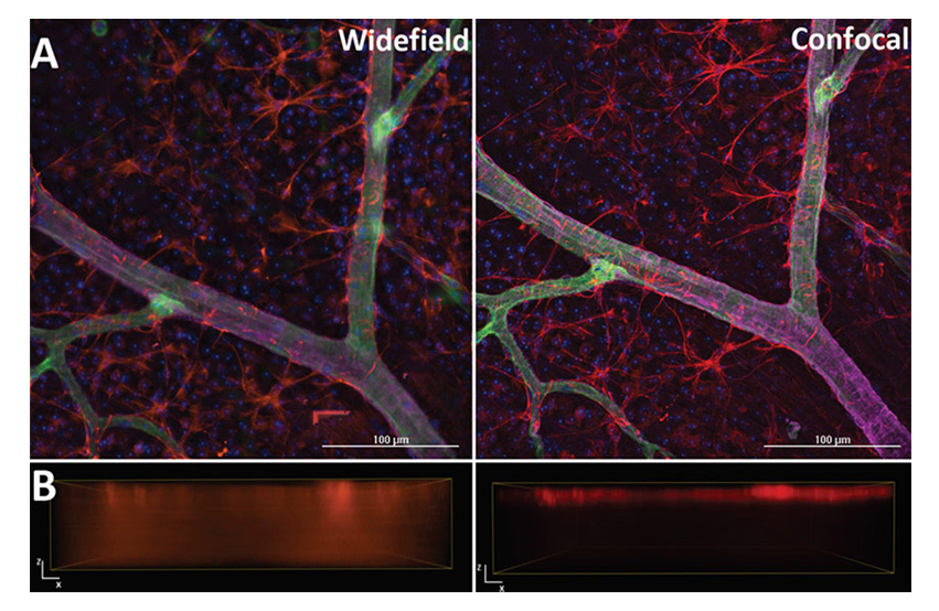 Confocal Fluorescence Imaging