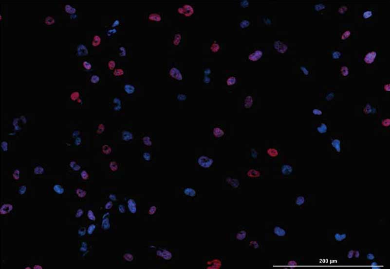 Automated Imaging and Dual-Mask Spot Counting of γH2AX Foci to Determine DNA Damage on an Individual Cell Basis