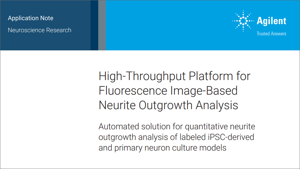 High-Throughput Platform for Fluorescence Image-Based Neurite Outgrowth Analysis