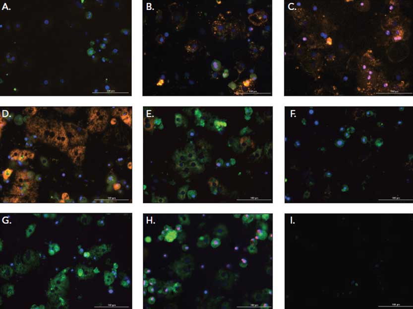 Long-Term Hepatotoxicity Studies using Cultured Human iPSC-Derived Hepatocytes