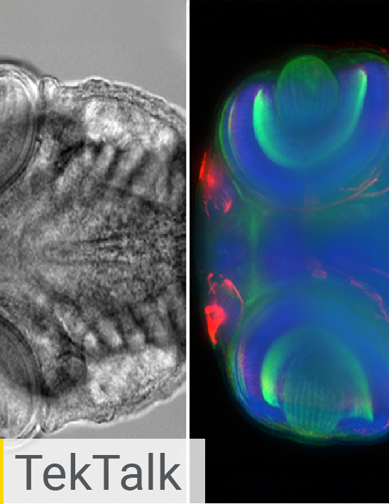 Viral Infectivity Assays