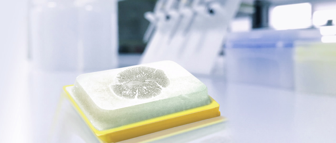 基于杂交的新一代测序 (NGS)