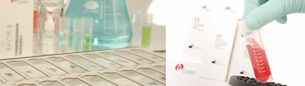 Blocking Reagents, Buffers, Diluents