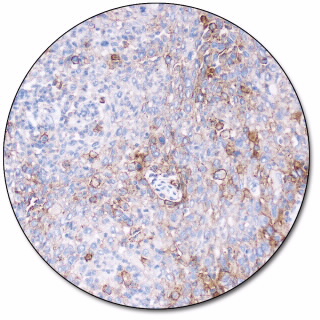 PD-L1 检测试剂盒（免疫组织化学法）